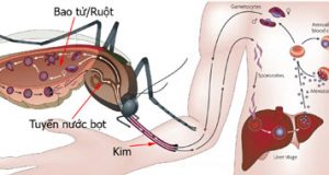 Bệnh sốt rét và biện pháp phòng chống