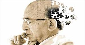 Hội chứng suy giảm trí nhớ Alzheimer